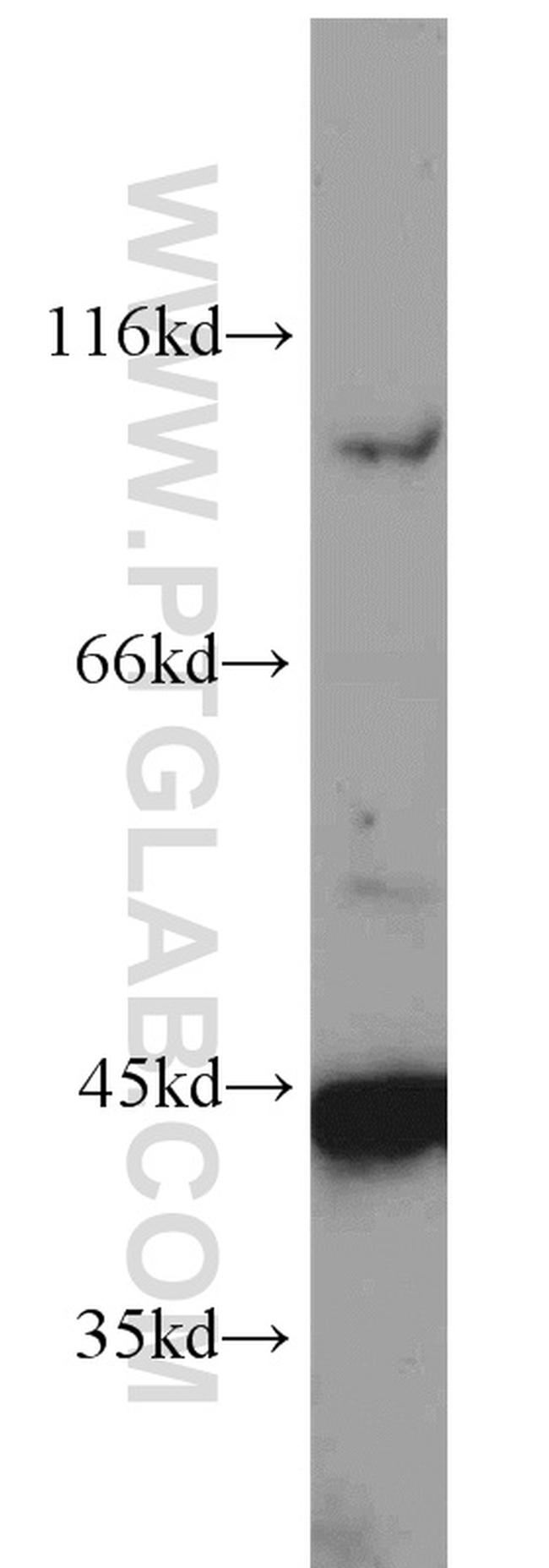 TNFAIP3 Antibody in Western Blot (WB)