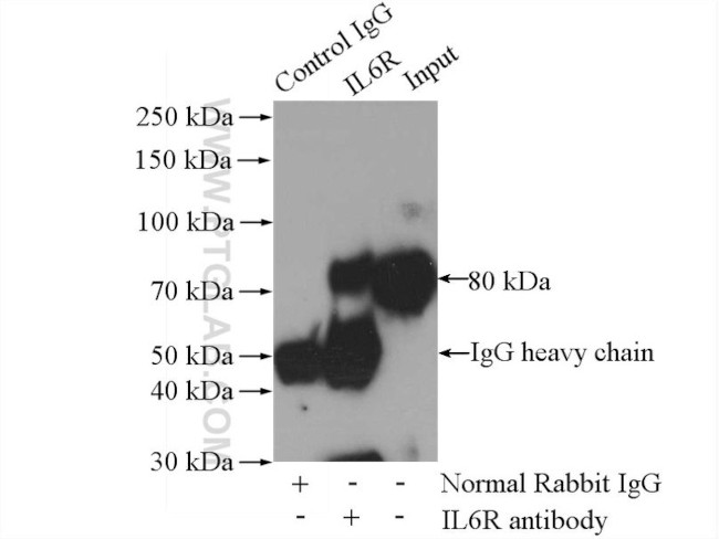 IL-6R Antibody in Immunoprecipitation (IP)