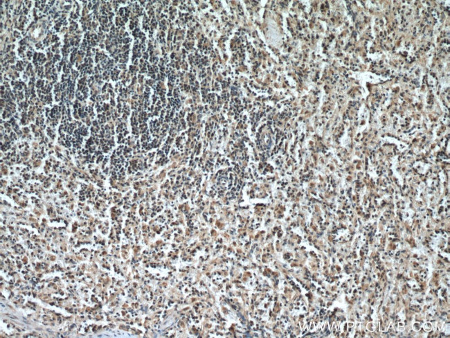 IL-6R Antibody in Immunohistochemistry (Paraffin) (IHC (P))