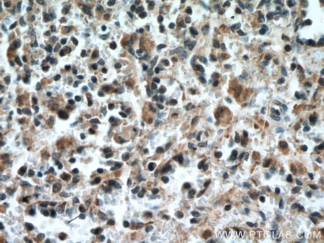 IL-6R Antibody in Immunohistochemistry (Paraffin) (IHC (P))