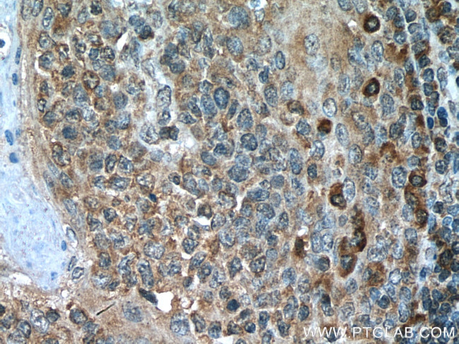 IL-6R Antibody in Immunohistochemistry (Paraffin) (IHC (P))