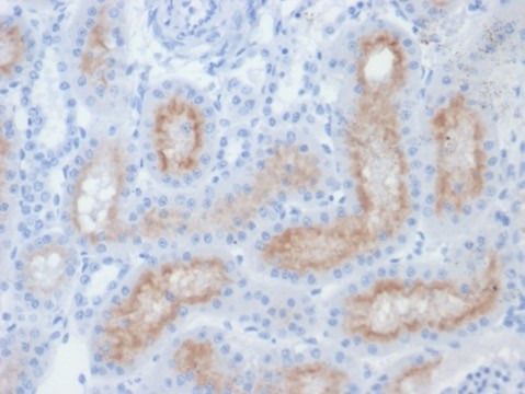 FOLH1/PSMA (Prostate Epithelial Marker) Antibody in Immunohistochemistry (Paraffin) (IHC (P))