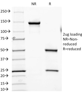 FOLH1/PSMA (Prostate Epithelial Marker) Antibody in SDS-PAGE (SDS-PAGE)