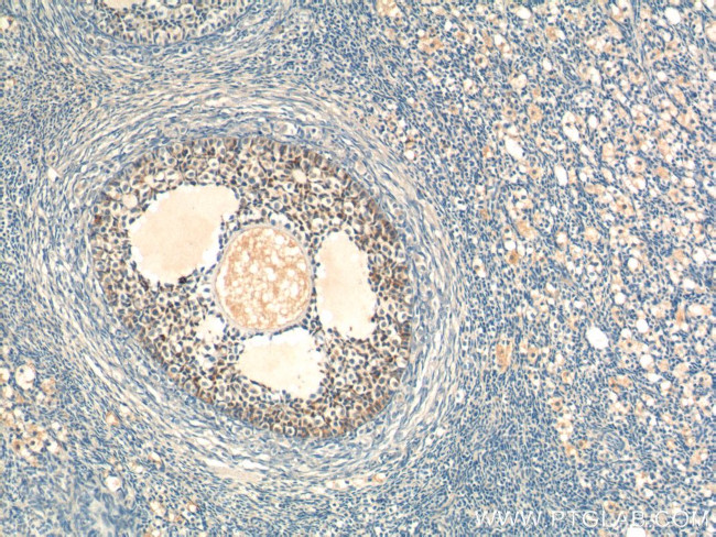 AMH Antibody in Immunohistochemistry (Paraffin) (IHC (P))