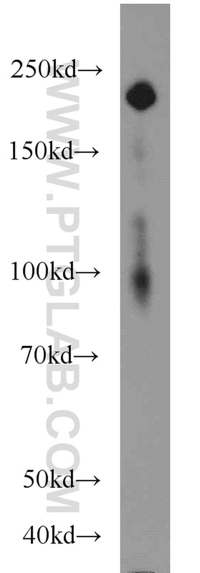 LAMB1 Antibody in Western Blot (WB)