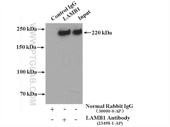 LAMB1 Antibody in Immunoprecipitation (IP)