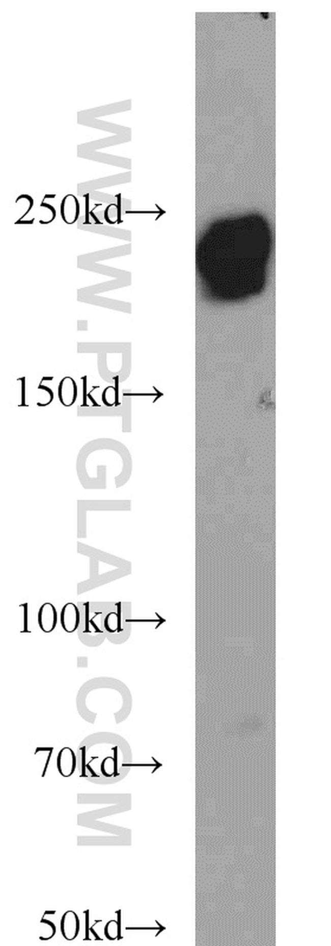 LAMB1 Antibody in Western Blot (WB)