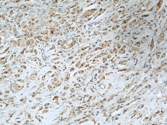 Mammaglobin A Antibody in Immunohistochemistry (Paraffin) (IHC (P))