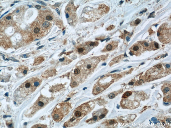 Mammaglobin A Antibody in Immunohistochemistry (Paraffin) (IHC (P))