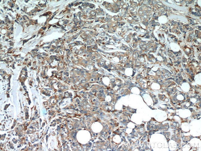 Mammaglobin A Antibody in Immunohistochemistry (Paraffin) (IHC (P))