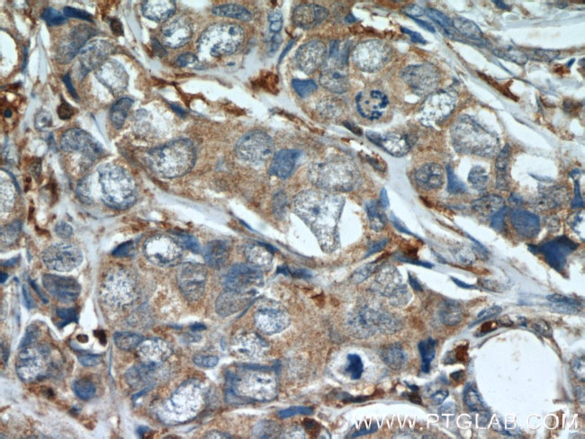 Mammaglobin A Antibody in Immunohistochemistry (Paraffin) (IHC (P))