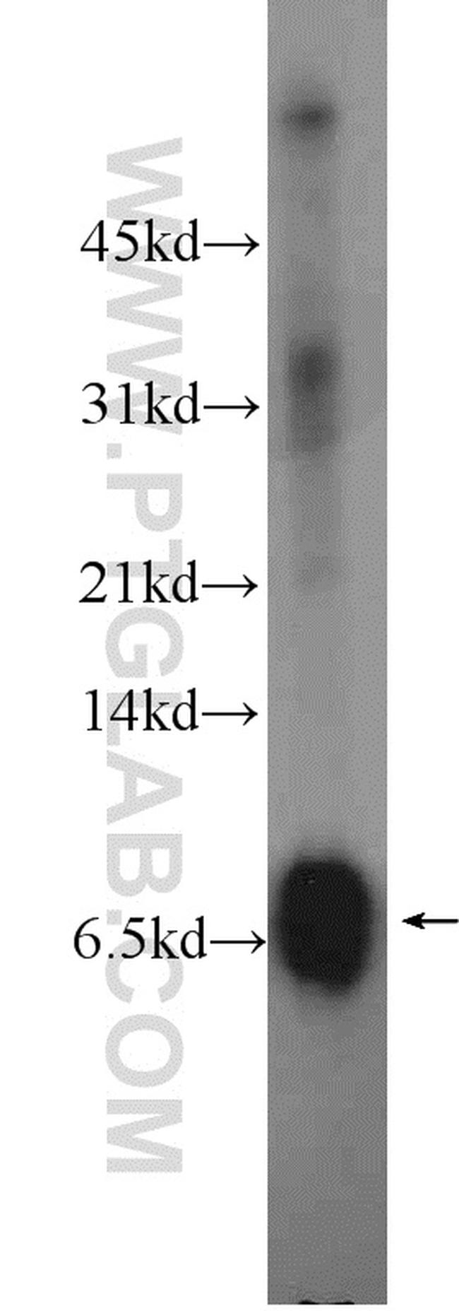 Mammaglobin A Antibody in Western Blot (WB)