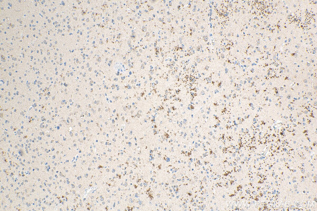 Ubiquilin 1 Antibody in Immunohistochemistry (Paraffin) (IHC (P))