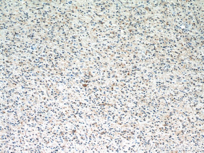 Ubiquilin 1 Antibody in Immunohistochemistry (Paraffin) (IHC (P))