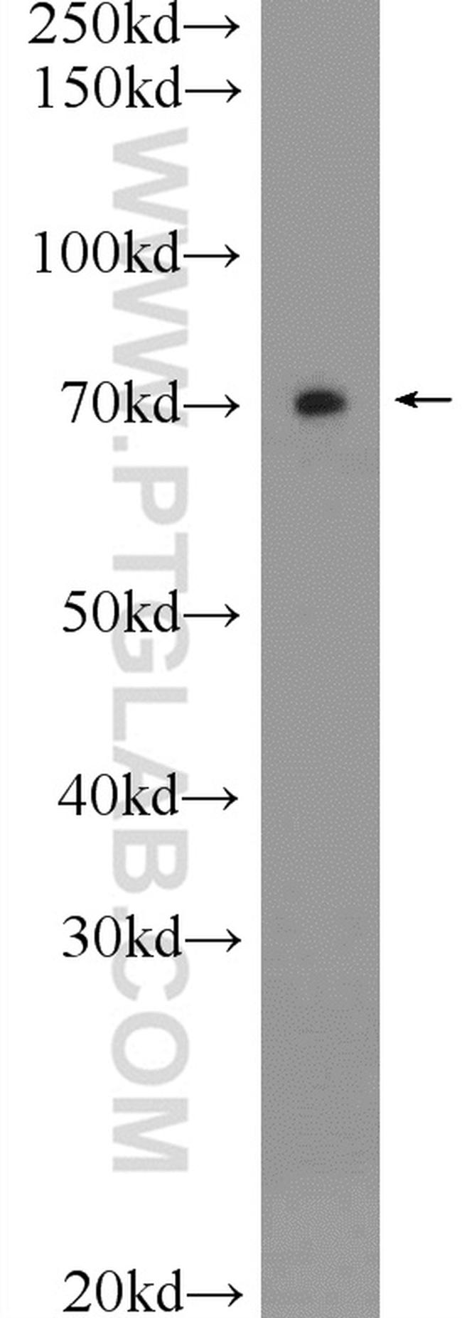 Ubiquilin 1 Antibody in Western Blot (WB)