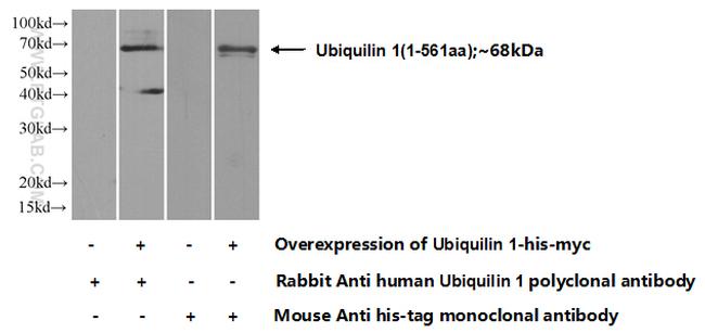 Ubiquilin 1 Antibody in Western Blot (WB)