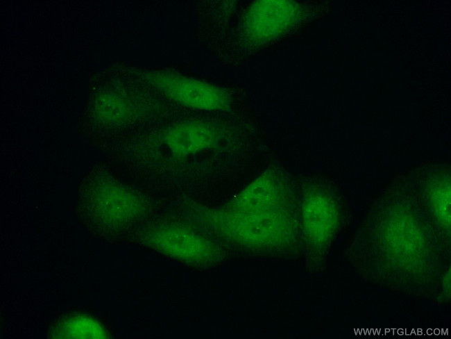 HOXD13 Antibody in Immunocytochemistry (ICC/IF)