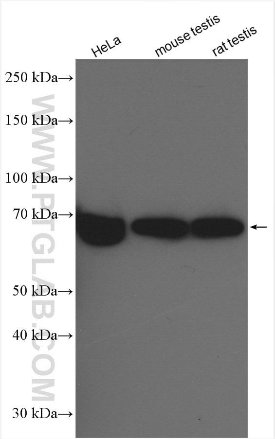 ESCO2 Antibody in Western Blot (WB)