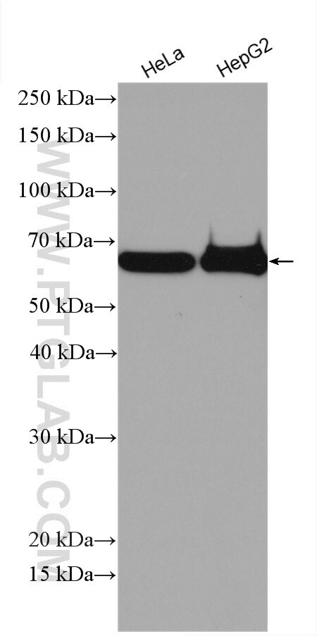 ESCO2 Antibody in Western Blot (WB)