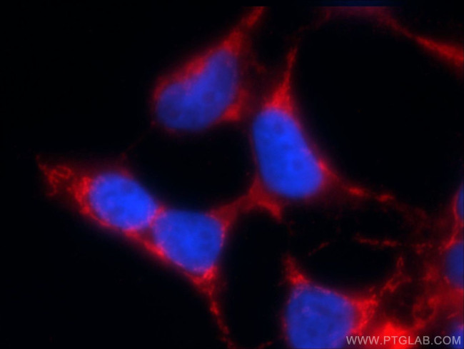 KGA/GAM/GAC Antibody in Immunocytochemistry (ICC/IF)