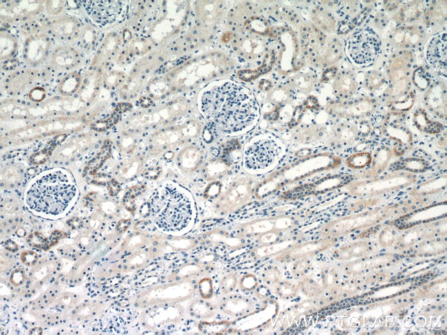 KGA/GAM/GAC Antibody in Immunohistochemistry (Paraffin) (IHC (P))