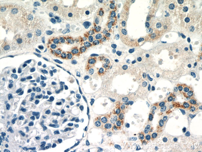 KGA/GAM/GAC Antibody in Immunohistochemistry (Paraffin) (IHC (P))