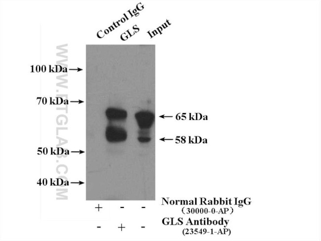 KGA/GAM/GAC Antibody in Immunoprecipitation (IP)