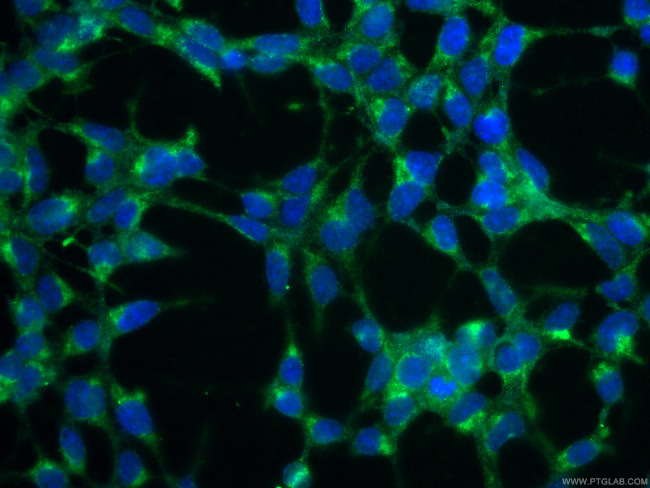 KGA/GAM/GAC Antibody in Immunocytochemistry (ICC/IF)