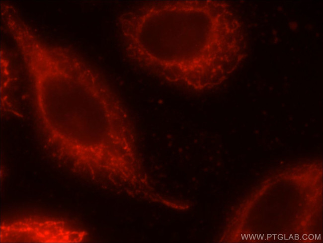 KGA/GAM/GAC Antibody in Immunocytochemistry (ICC/IF)