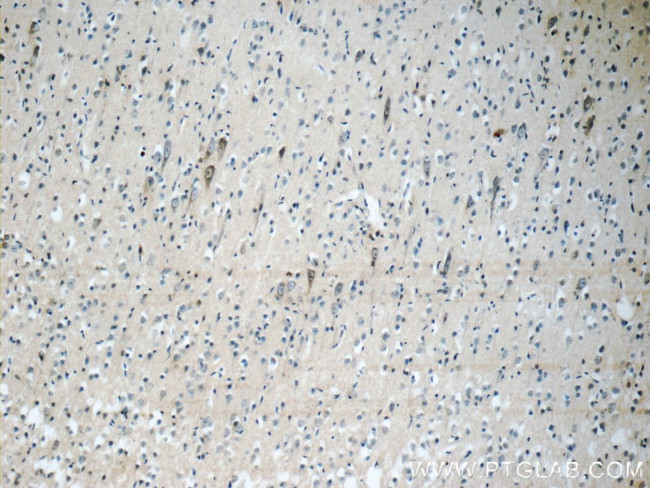 KGA/GAM/GAC Antibody in Immunohistochemistry (Paraffin) (IHC (P))