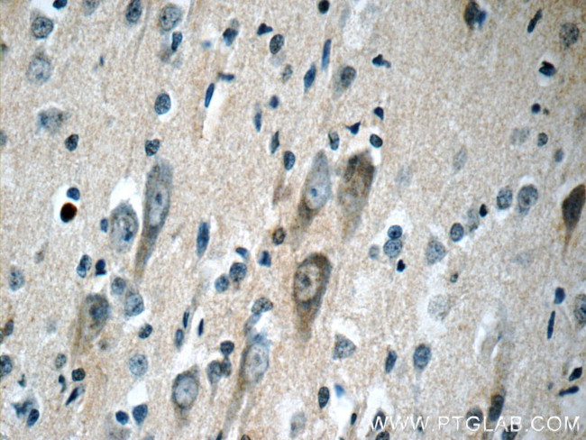 KGA/GAM/GAC Antibody in Immunohistochemistry (Paraffin) (IHC (P))