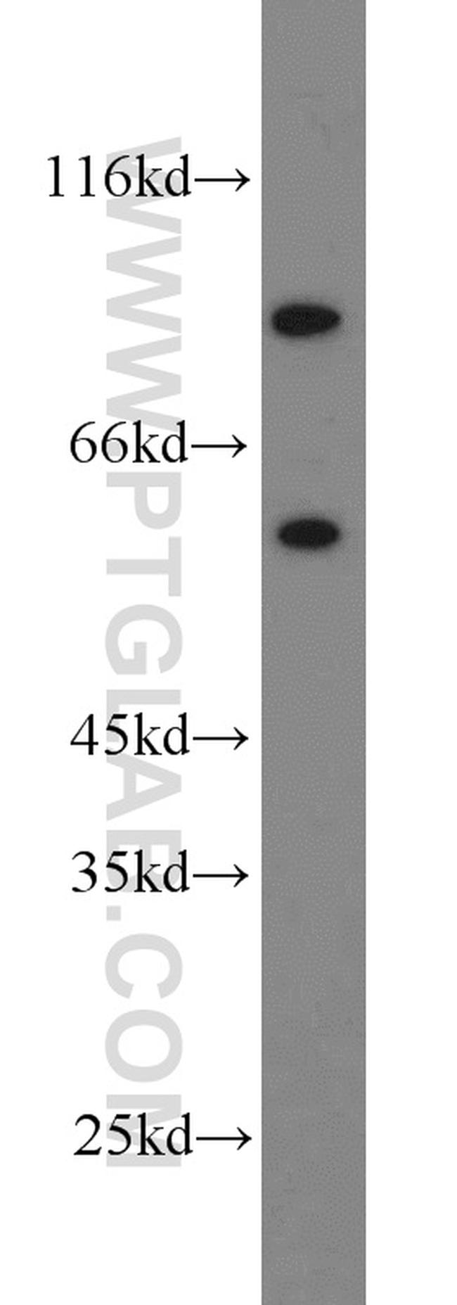 KGA/GAM/GAC Antibody in Western Blot (WB)