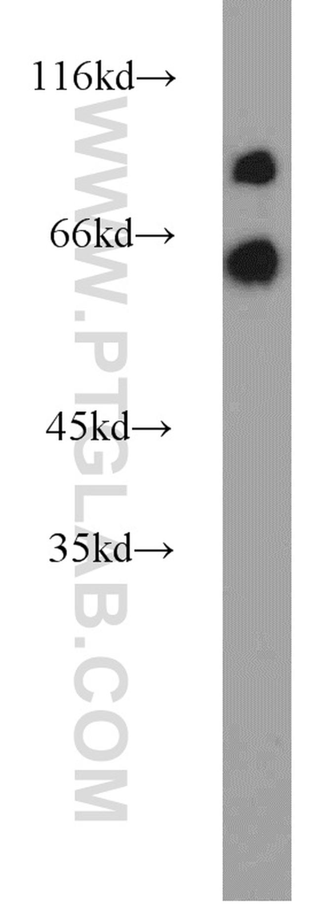 KGA/GAM/GAC Antibody in Western Blot (WB)