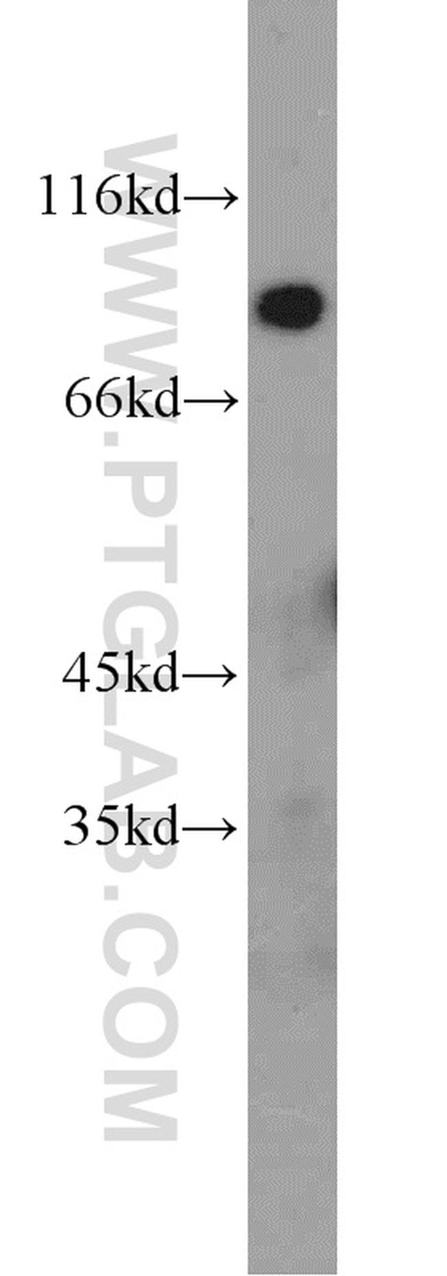 KGA/GAM/GAC Antibody in Western Blot (WB)