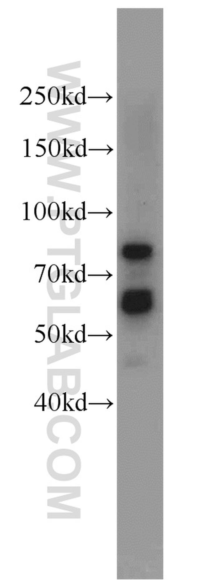 KGA/GAM/GAC Antibody in Western Blot (WB)