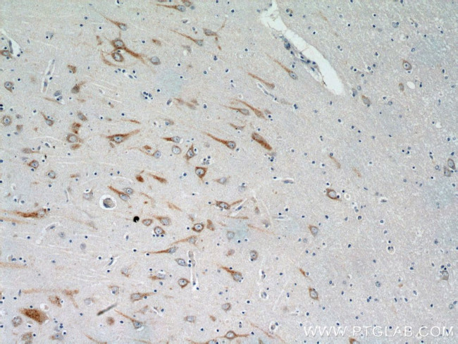 HTR6 Antibody in Immunohistochemistry (Paraffin) (IHC (P))