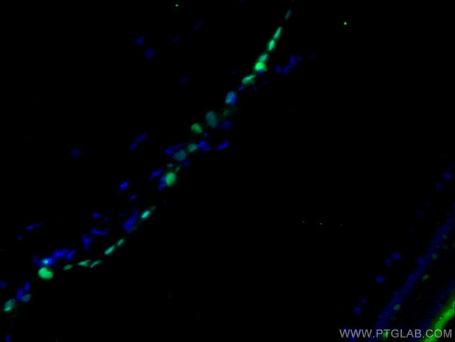 VSX1 Antibody in Immunohistochemistry (PFA fixed) (IHC (PFA))