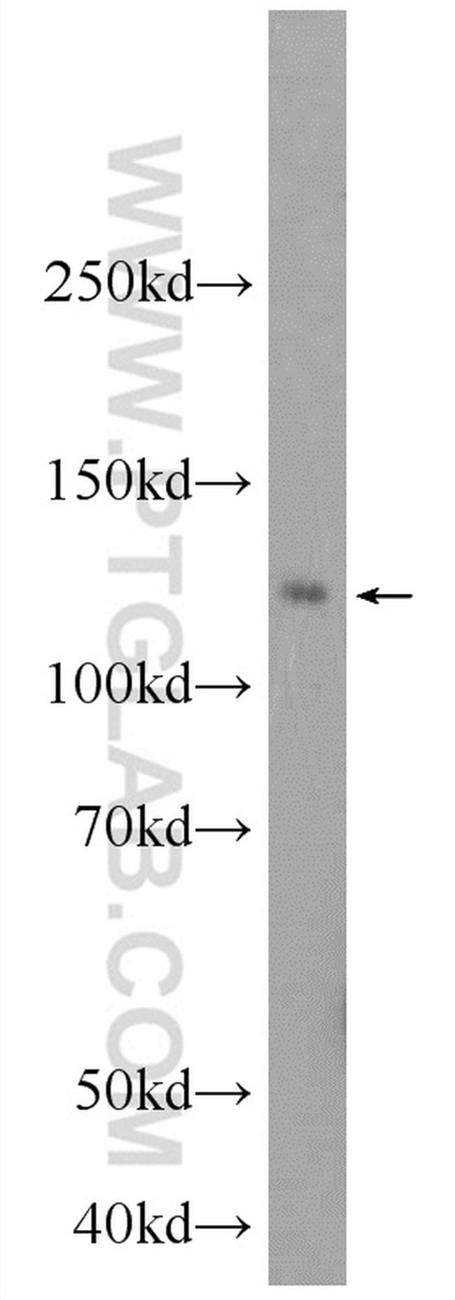 NFKB1 Antibody in Western Blot (WB)