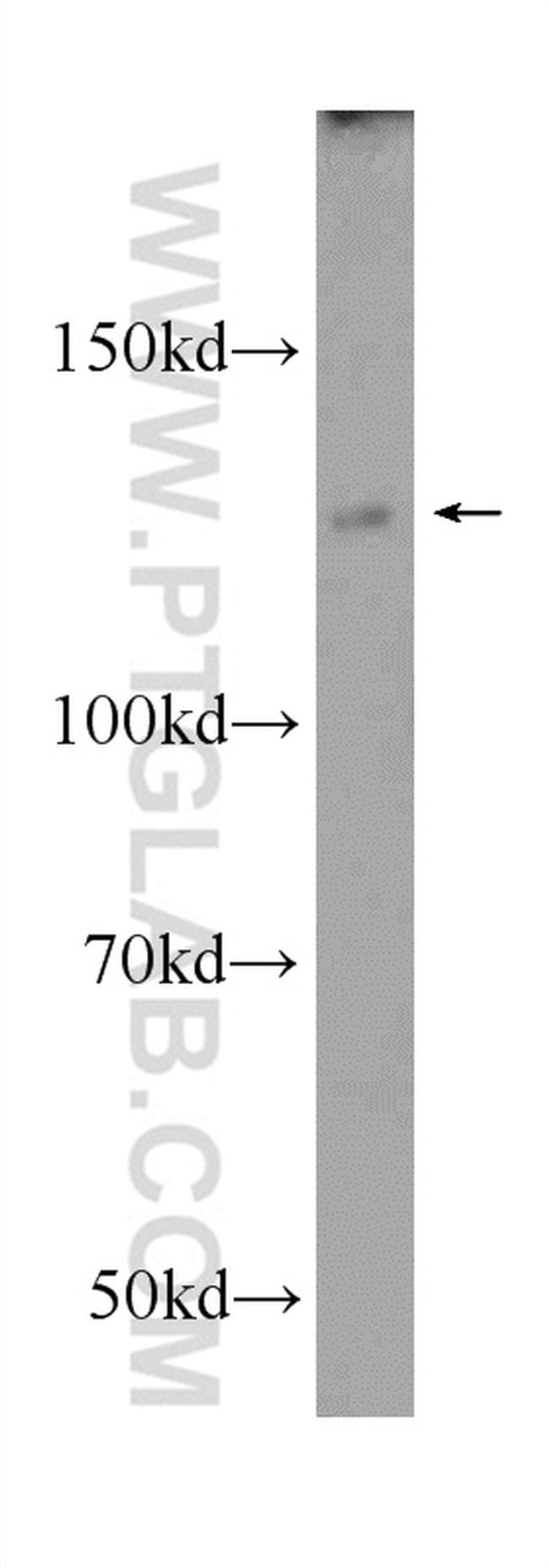 NFKB1 Antibody in Western Blot (WB)