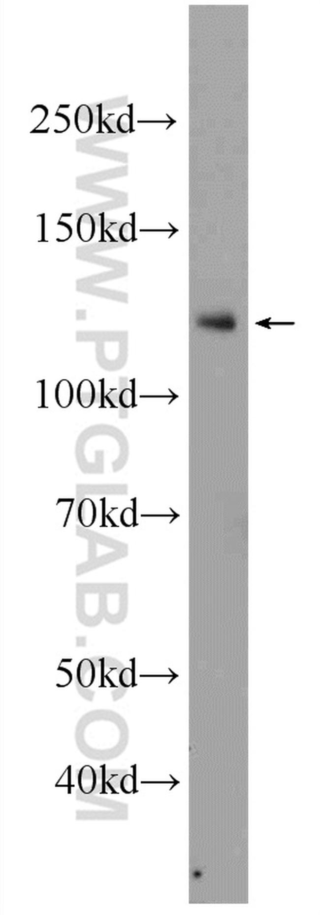 NFKB1 Antibody in Western Blot (WB)