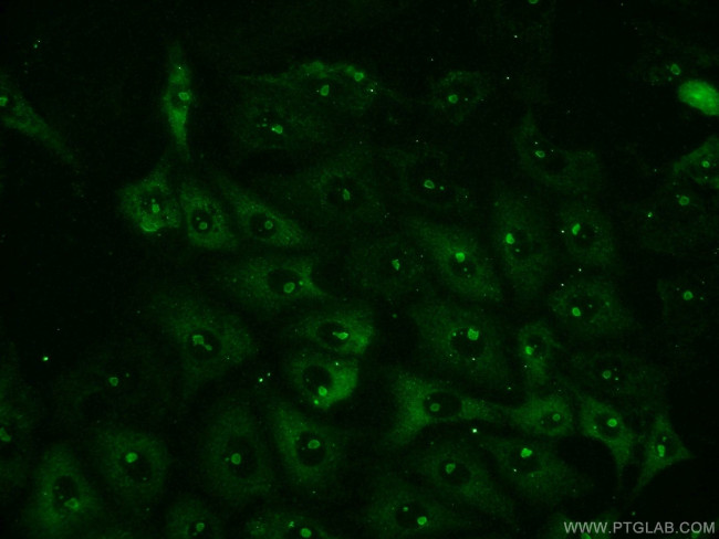 NFKB1 Antibody in Immunocytochemistry (ICC/IF)