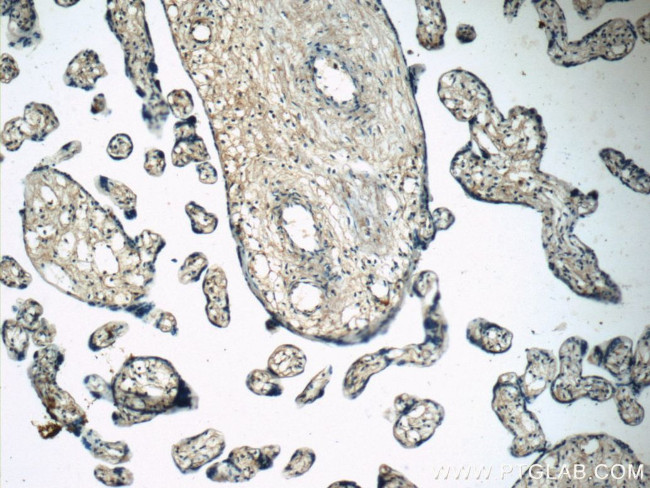 NFKB1 Antibody in Immunohistochemistry (Paraffin) (IHC (P))