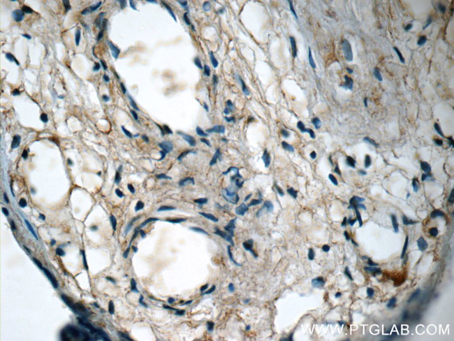 NFKB1 Antibody in Immunohistochemistry (Paraffin) (IHC (P))