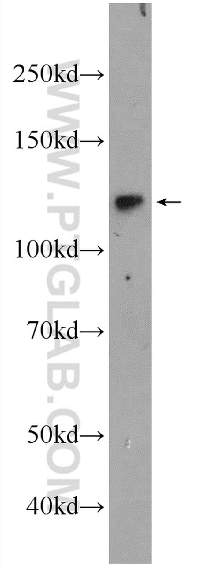 NFKB1 Antibody in Western Blot (WB)