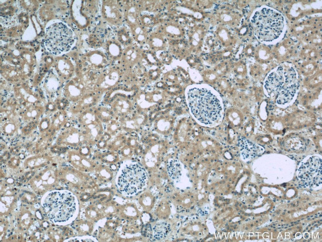 GRB10 Antibody in Immunohistochemistry (Paraffin) (IHC (P))