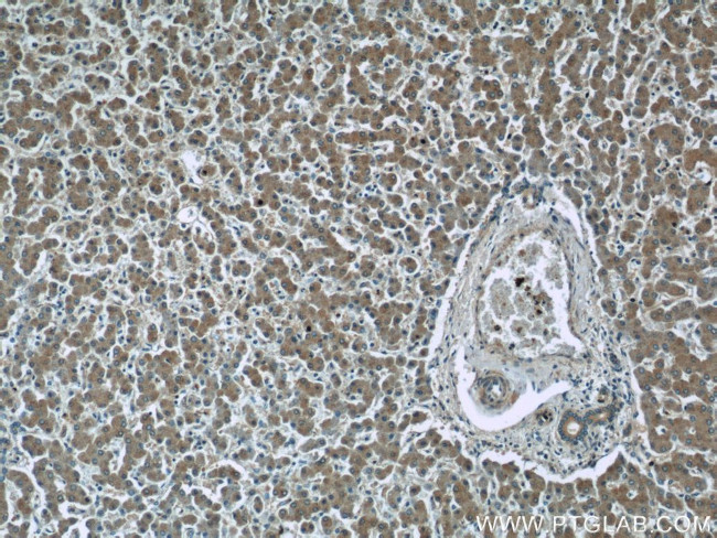 GRB10 Antibody in Immunohistochemistry (Paraffin) (IHC (P))