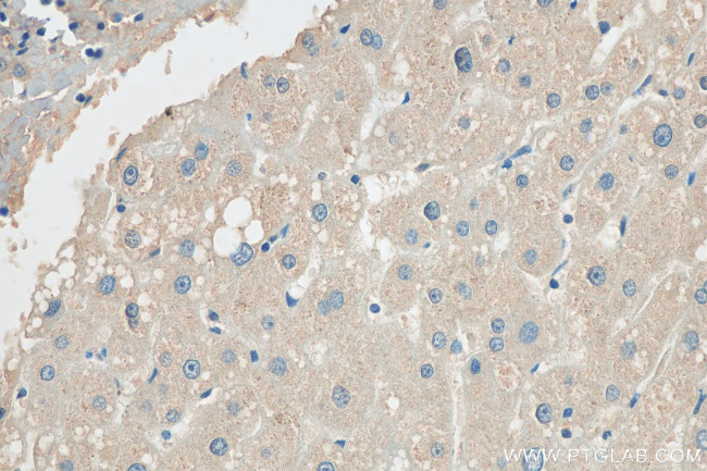 GRB10 Antibody in Immunohistochemistry (Paraffin) (IHC (P))