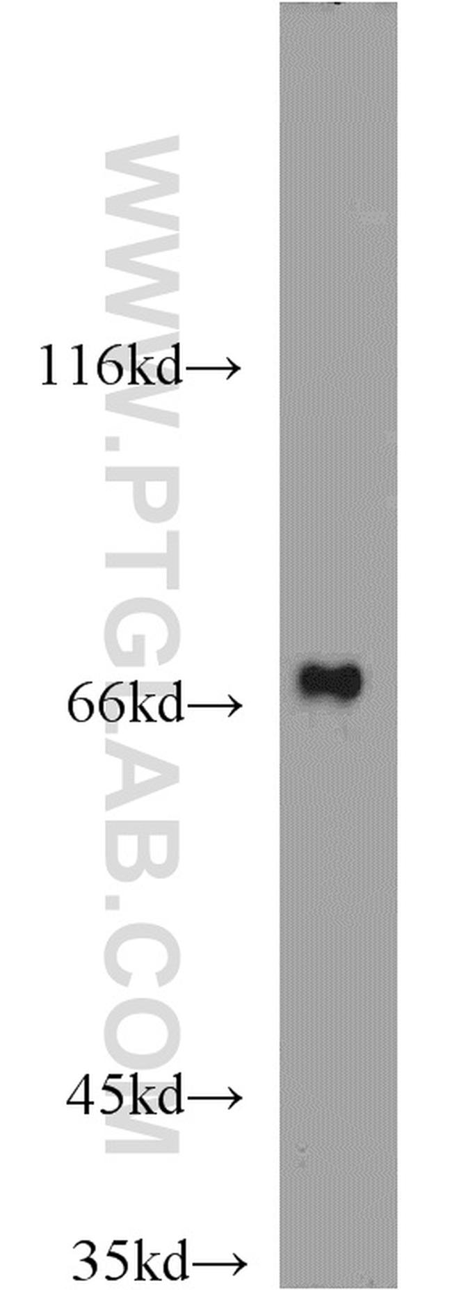 GRB10 Antibody in Western Blot (WB)