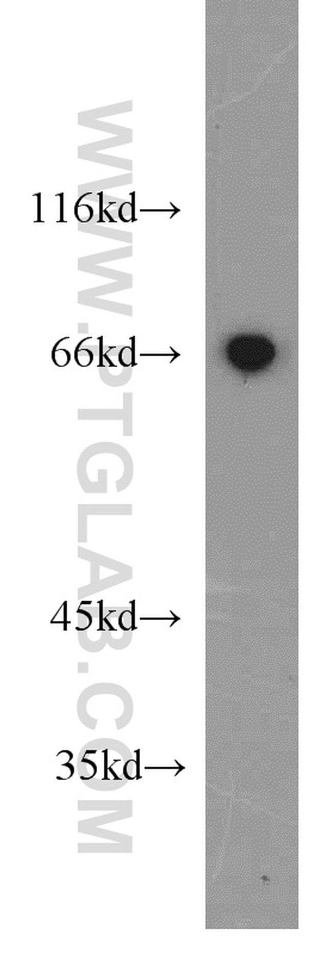 GRB10 Antibody in Western Blot (WB)