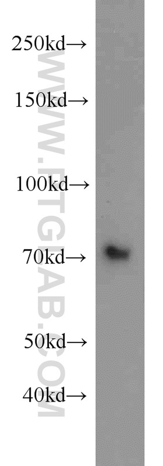 GRB10 Antibody in Western Blot (WB)